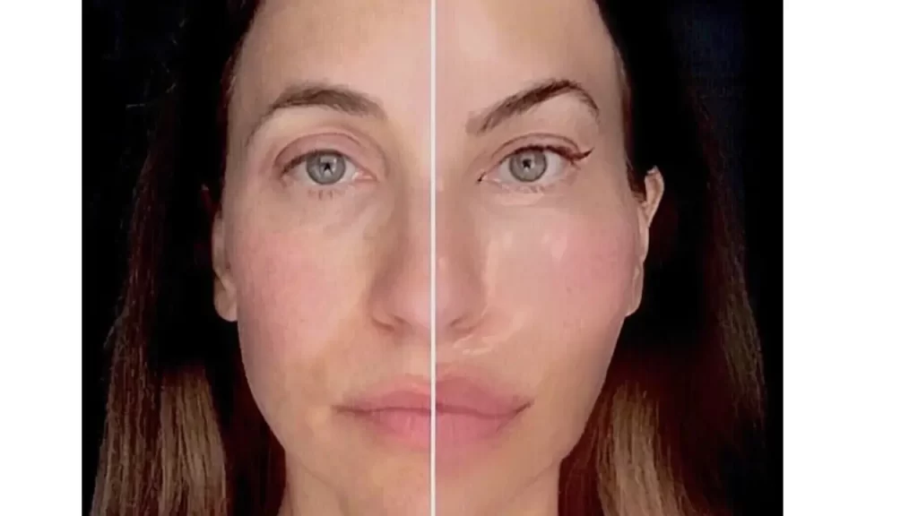 Comparação entre resultado natural e excessivo em procedimentos estéticos